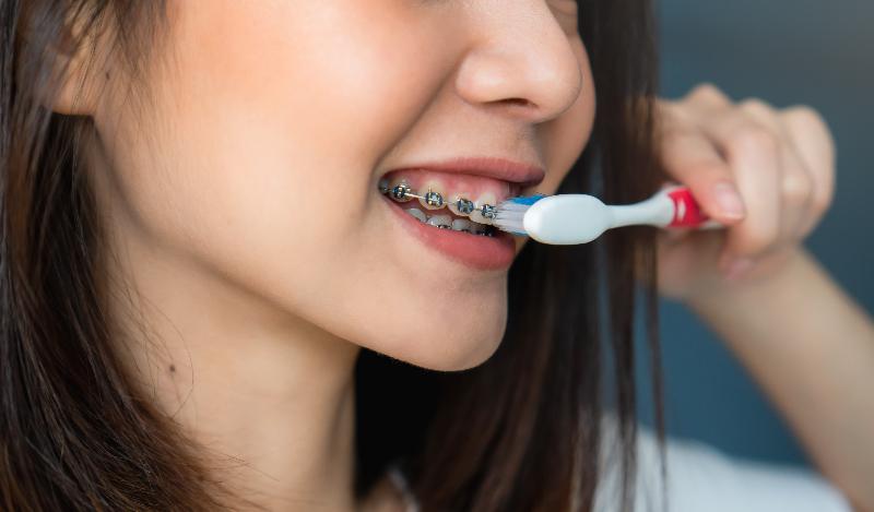 Lavar dientes ortodoncia Lavar dientes ortodoncia