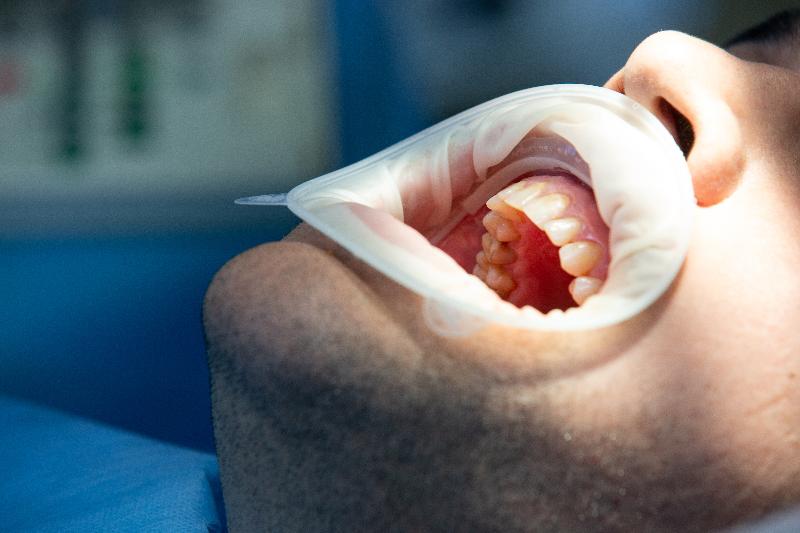 Cirugía periodontal Cirugía periodontal