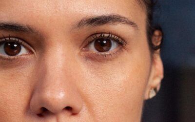 Ojeras oscuras: causas y mejores tratamientos