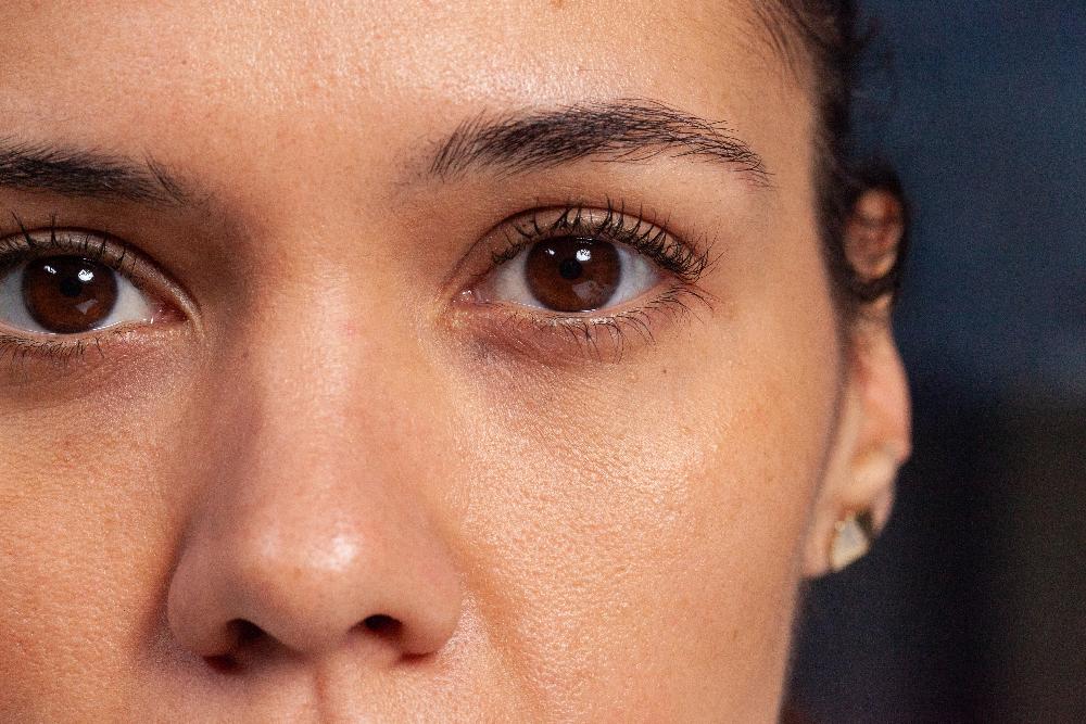 Ojeras oscuras
