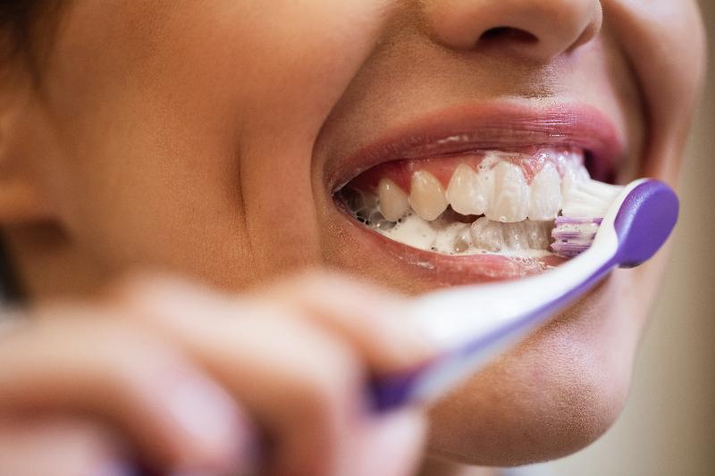 Causas de la caries Causas de la caries