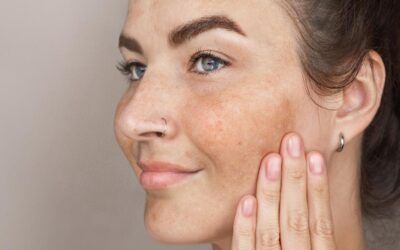 Cómo evitar las manchas de sol en la cara
