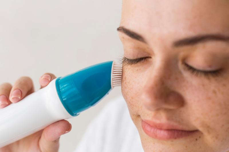 Tratamientos para manchas solares